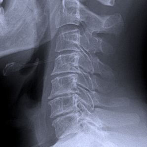 Radiografía de columna